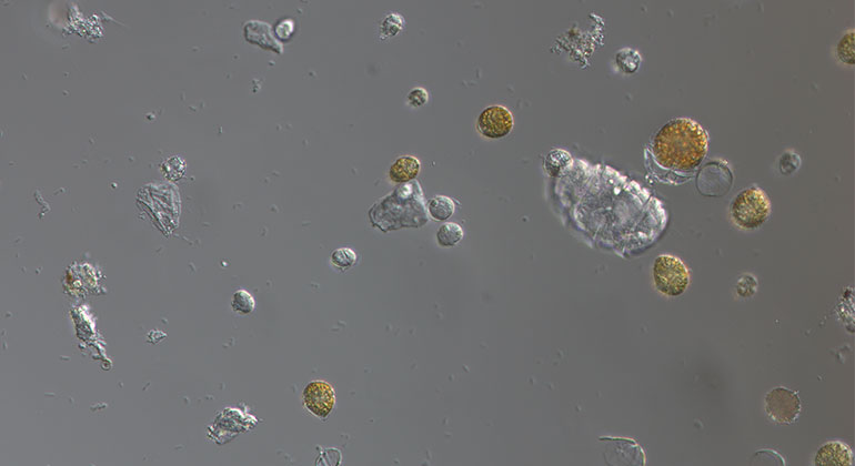 Små dinoflagellater som ser guld- och silverfärgade ut. 