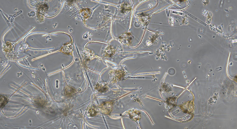Mikroskopbild över flagellater.