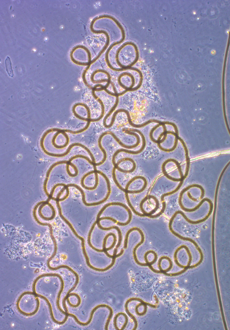 Mikroskopbild av Nodularia Spumigena. Foto: SMHI